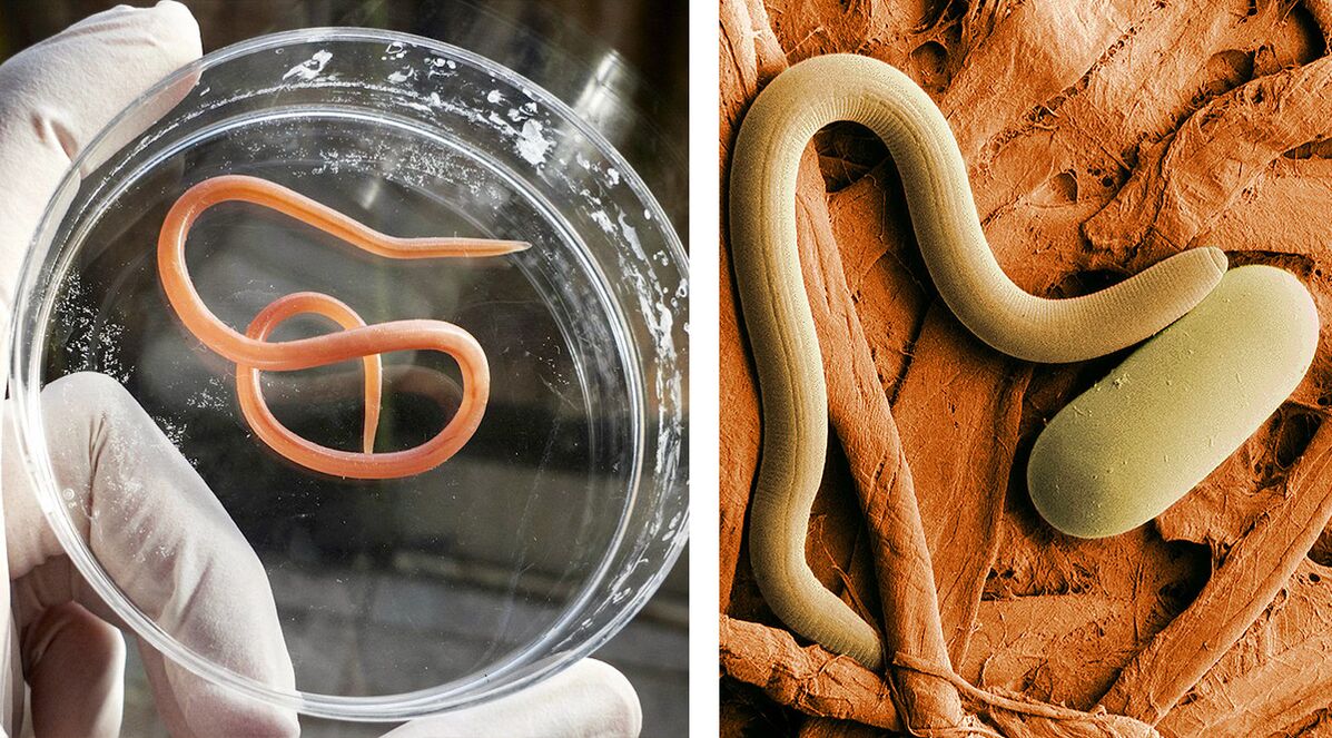 Παράσιτα στο ανθρώπινο σώμα